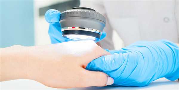 Как отличить псориаз от дерматита