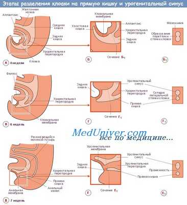 Разделение клоаки на прямую кишку и урогенитальный синус