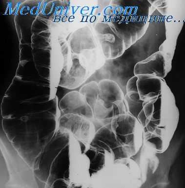 секреция желудка