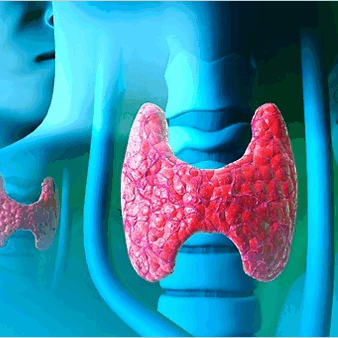 Рак щитовидной железы