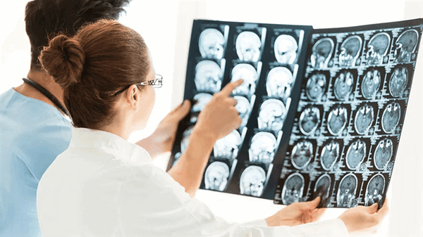 Диффузное аксональное повреждение головного мозга (вопросы визуализации)