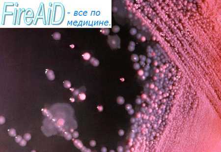 Особенности инфекционных болезней. Специфичность инфекции. Контагиозность.