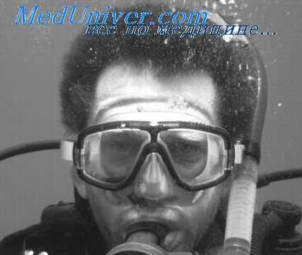 газовая эмболия сосудов