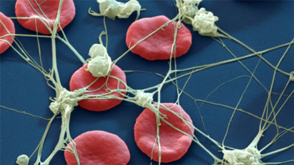 Нити фибрина