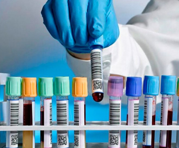 Исследование фибриногена