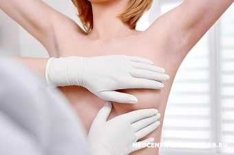 Дисгормональные заболевания молочных желез