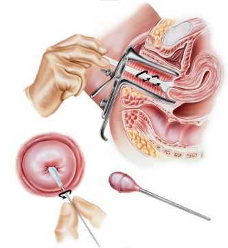Цитологический мазок с шейки матки