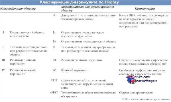 Классификация дивертикулярной болезни