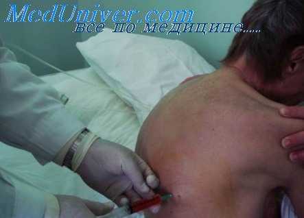 туберкулез плевры