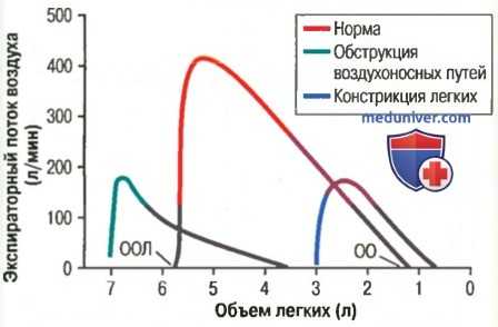 Нарушения вдоха. Максимальный экспираторный поток
