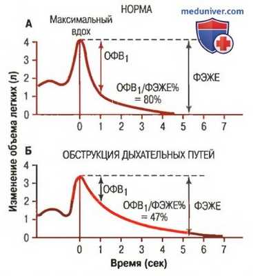 Дыхание при астме. Изменения дыхания при туберкулезе