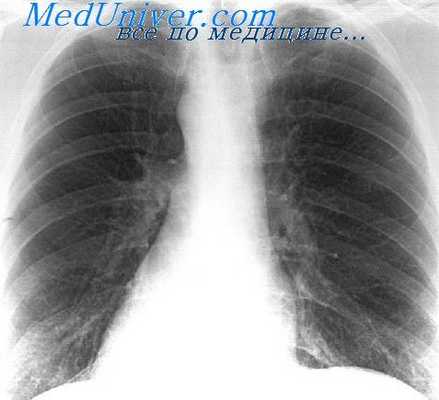 рентгенокимография