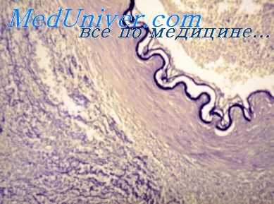 адреноблокаторы