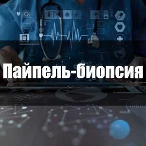 Пайпель-биопсия