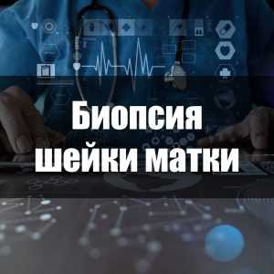 Биопсия шейки матки