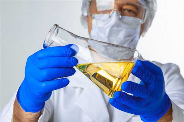 You are currently viewing Кровь в моче - гематурия. Диагностика, возможные причины