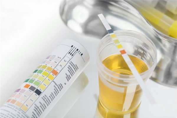 Анализ на белок в моче