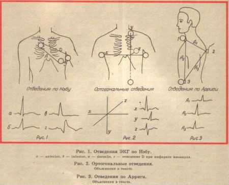 ЭКГ по Небу