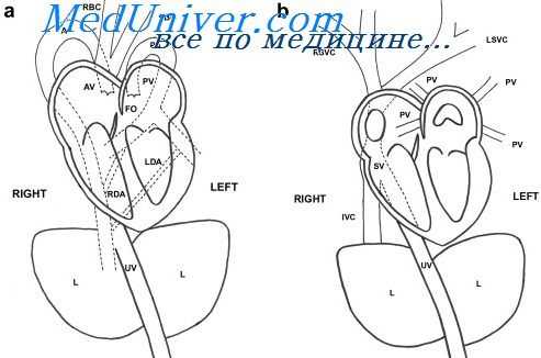 узи брахиоцефальных артерий