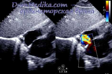 гемодинамика