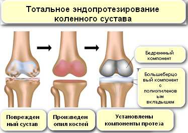 Ход операции и техники проведения