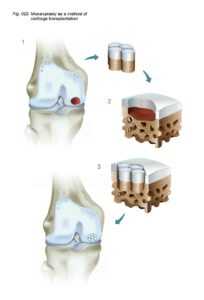 Схематичное изображение мозаичной пластики.
