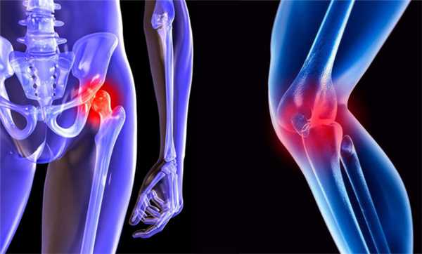 Эндопротезирование суставов