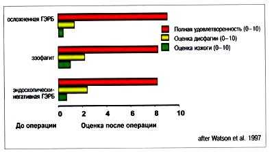 Рис. 8. Хирургическое лечение упорствующей дисфагии после фундопликации по Nissen