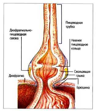 Рис. 1. Анатомическое строение перехода пищевода в желудок