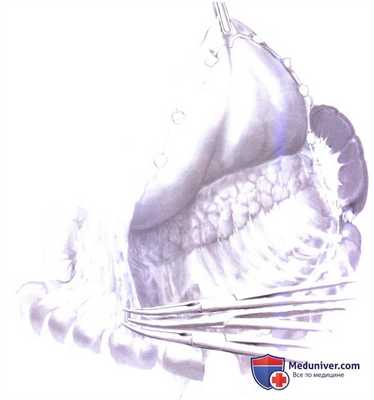 Дренирование протока в тонкую кишку при хроническом панкреатите (боковая панкреатикоеюностомия, модифицированная операция Пуэстоу (Puestow))