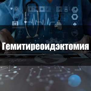 Гемитиреоидэктомия