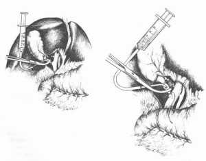 Холангиография