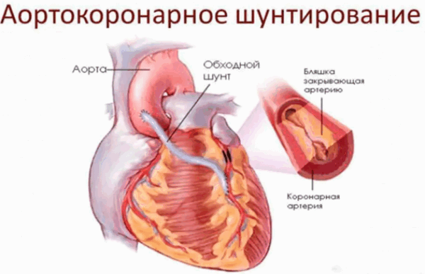 Понятие и сущность