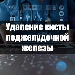 Удаление кисты поджелудочной железы