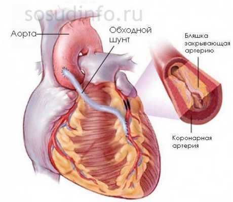 Как выполняется АКШ?
