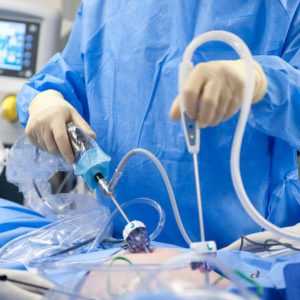 Лапароскопия