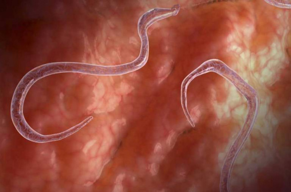 Дракункулез