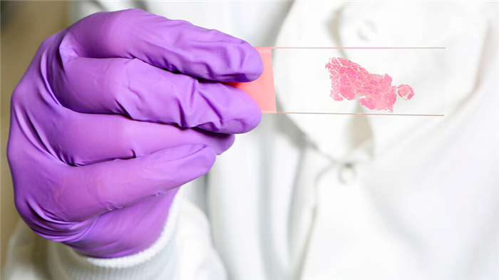 Исследование мазка из соска молочной железы