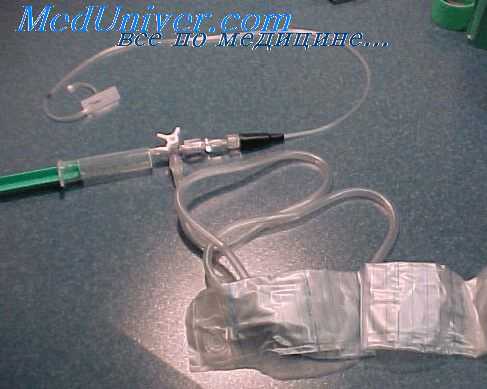 гнойные очаги