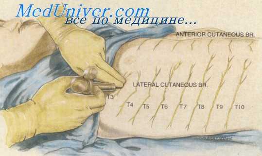 кавернотомия