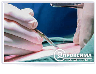 Вскрытие флегмоны (абсцесса)