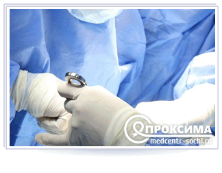 Осложнения после вскрытия флегмоны