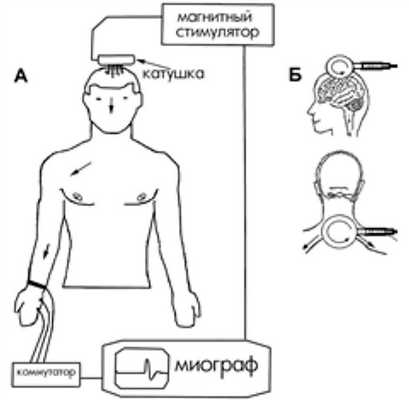 Схема процесса ТМС и расположения катушки