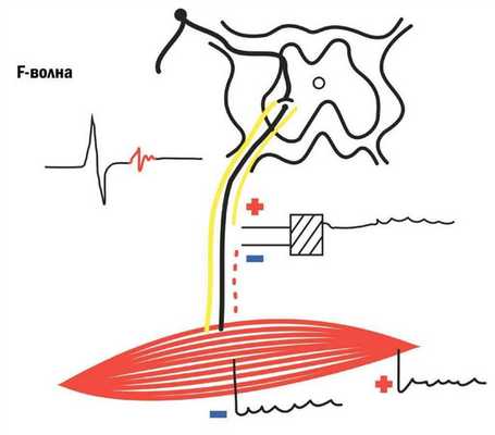F-волна при стимуляции мышцы