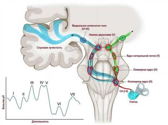 Пики потенциалов слухового анализатора в мозгу