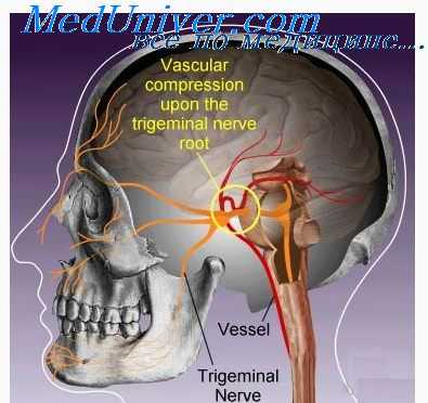 тройничный нерв