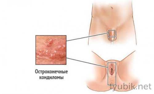 Как выглядит патология