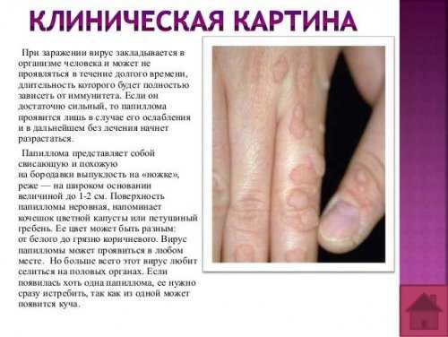 Клиническая картина ВПЧ