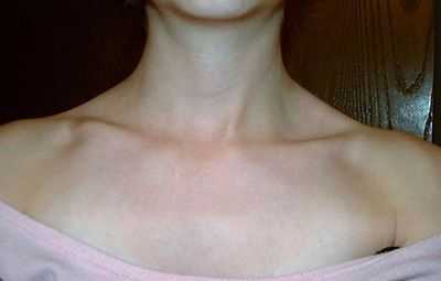 Яремная вена