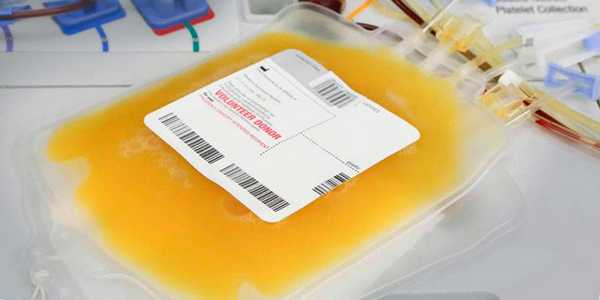 Тромбоцитарная масса